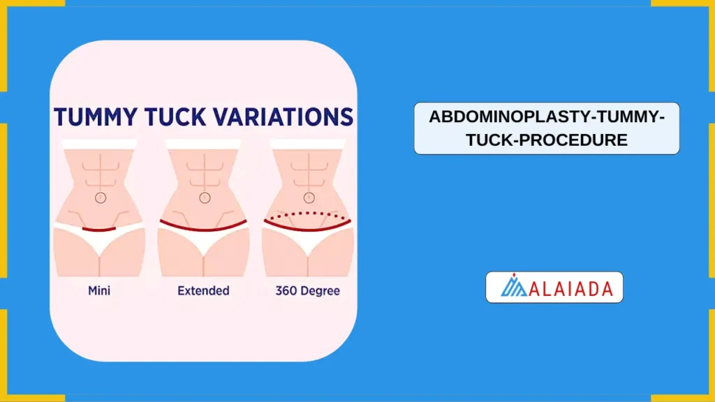 Comparing Abdominoplasty with Other Body Contouring Procedures