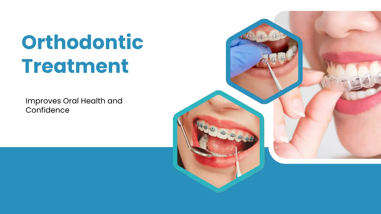How Orthodontic Treatment Improves Oral Health and Confidence